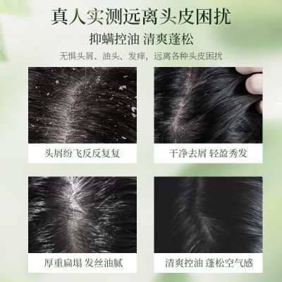 维特丝轻颂花语洗发水控油蓬松去屑止痒洗头膏沐浴露洗护套装批发图2