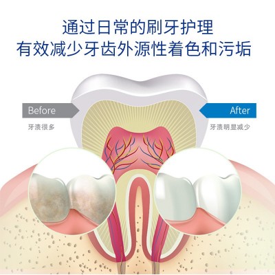 弗利民博士烟渍净牙膏 清新口气亮白现货批发 FLM0008（新包装）图3