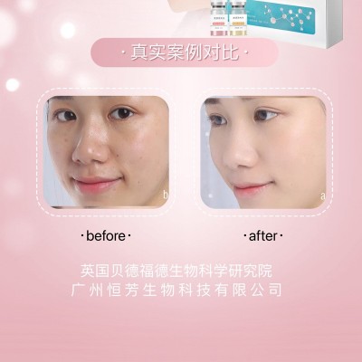 美容院线专用护肤品水光动能素精华液水光针产品玻尿酸VC导入原液图2