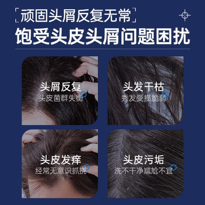 名欧去屑止痒洗发液平衡清爽无屑老姜修护干燥发丝柔顺洗发水图3